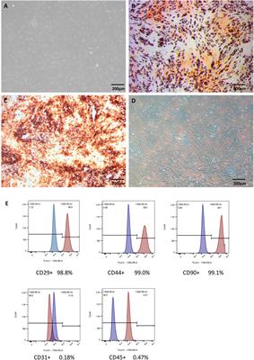 Dexmedetomidine regulates the anti-oxidation and autophagy of adipose-derived stromal cells under H2O2-induced oxidative stress through Nrf2/p62 pathway and improves the retention rate of autologous fat transplantation